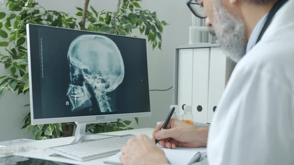 Doctor Radiologist Analyzing Human Skull Images Looking at Computer Screen and Witing Indoors in alt