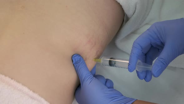 Doctor Makes Injection Ozone Gas Patient Abdomen Side Ozone Therapy