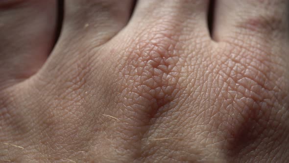 Macro Human Skin Background alt