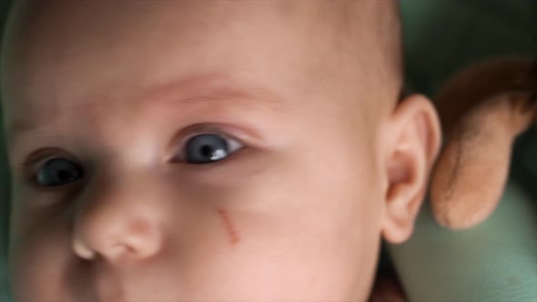 Closeup of the Blue Eyes of a Baby with a Scratch on the Cheek
