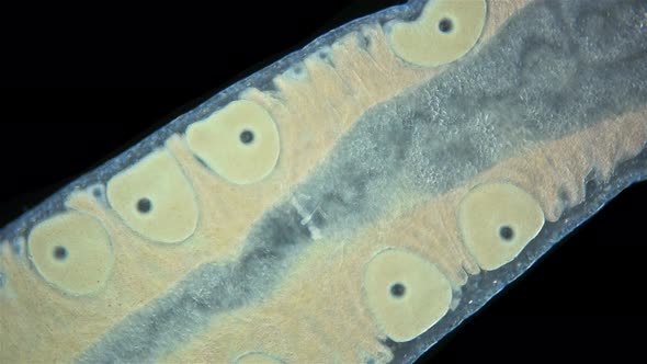 Worm Nemertea Prostoma sp. under microscope, of Tetrastemmatidae family alt