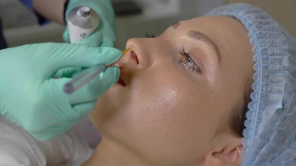 Anesthesia the Surface of the Lips Before Injection of Hyaluronic Acid alt
