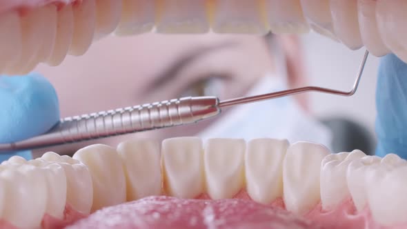 Dentist Making a Tooth Filling with Probe alt