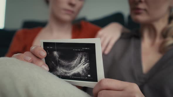Hand holding ultrasound scan and two women in the background. Shot with RED helium camera in 8K. alt