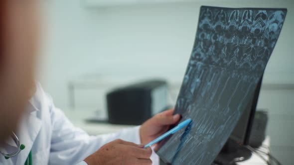 Closeup View From Back of Male Patient Listening Mature Adult Doctor Explaining Results of MRI alt