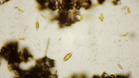 Freshwater Diatoms Under The Microscope alt