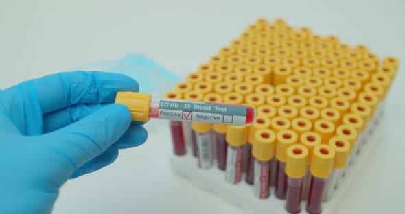 Researcher Hand Holding Test Tube for Checking Covid-19 in the Blood alt