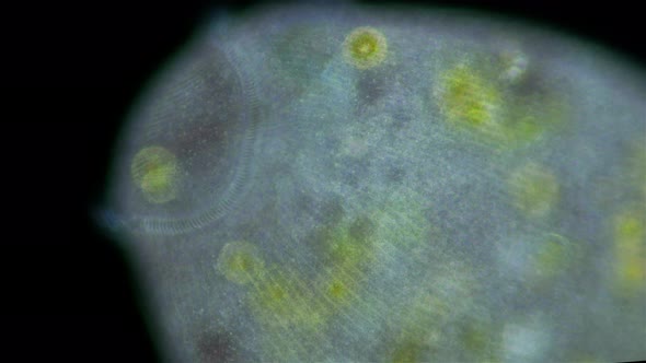 Stentor Ciliophora Infusoria Under Microscope Family Stentoridae Class Ciliata Order Heterotrichida alt
