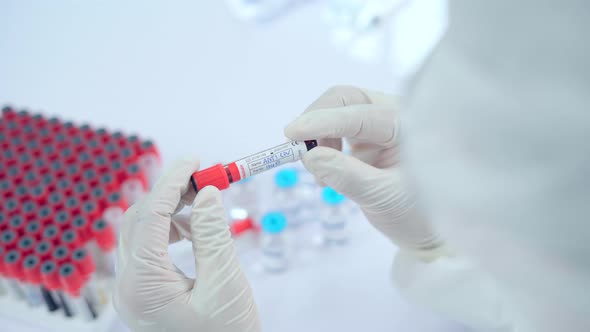 Doctor or Scientist checking sampling blood tube to make a medical diagnosis.