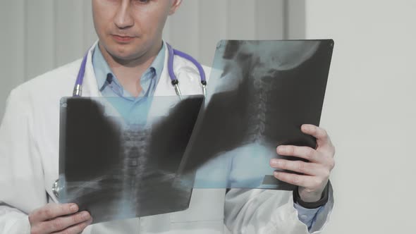 Cropped Shot of a Doctor Examining Xray Scans of a Patient alt