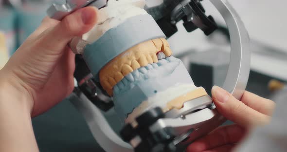 Dental Technician Makes a Plaster Cast of Jaw Models in an Articulator