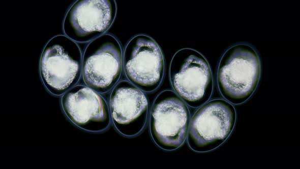 Eggs with Mollusca Nudibranchia embryos under a microscope, possibly Superfamily Fionoidea alt