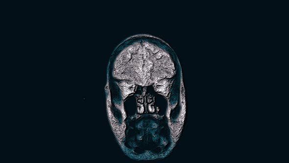 Voluminous Color MRI Brain, Head Scans and Tumor Detection. Diagnostic Medical Tool alt