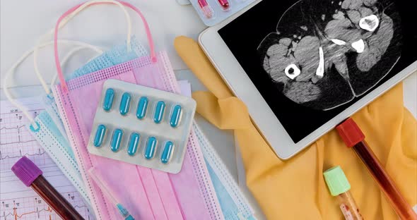 Medicall Office Report of MRI Scan of the Patient in Showing in Digital Tablet and Pills alt