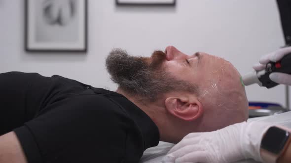 Close Up Bearded Bold Man Head Depilation Laser Hair Removal Procedure Treatment Unpainful Procedure alt
