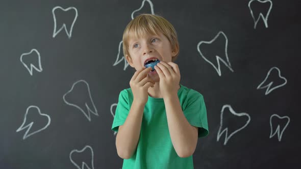 Little Boy Shows His Dental Trainer. Silicon Burl for the Formation of the Correct Bite in Children alt