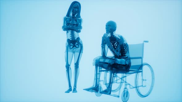 Man in Wheelchair with Visible Bones