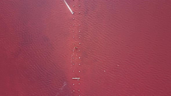 Woman Is Sunbathing in a Striped Bathing Suit