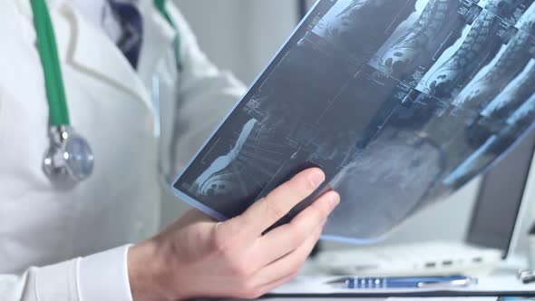 Modern Doctor Radiologist Examining An X Ray