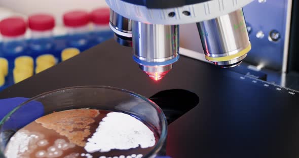 Bacteria colonies under the microscope alt