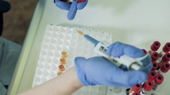 Biological Fluids Are Being Poured Into Test Tubes. Coronavirus, Covid-19 Laboratory Test alt