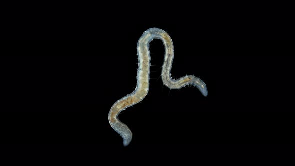 Worm Nais sp. under a microscope, Family Naididae, a class of Oligochaeta alt