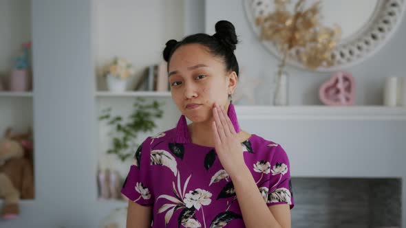 Young Asian Beautiful Girl with Problem Skin