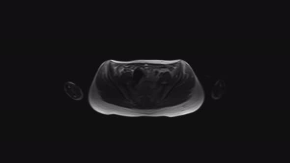 MRI of the Female Pelvic Organs, Abdominal Cavity, Gastrointestinal Tract and Bladder alt