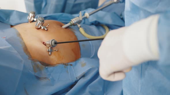 Instruments for Laparoscopic Surgery at Work alt