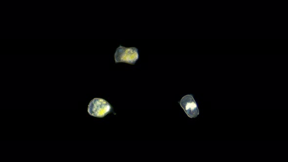 Infusoria Vorticella Under the Microscope, Class Oligohymenophorea. alt