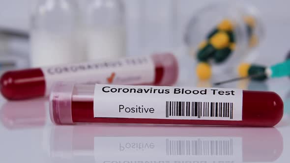 Blood Test Tube with Coronavirus Disease Closeup