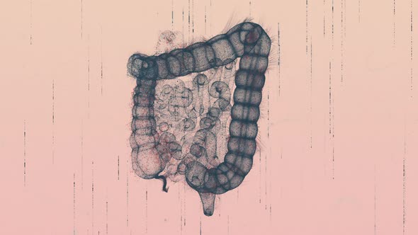 Intestines X-Ray