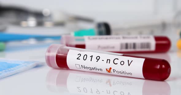 Blood Test Tube with Coronavirus Disease