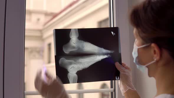 Doctor Examines Xray Film of Broken Foot