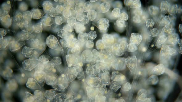 Infusoria Vorticella Under the Microscope, Class Oligohymenophorea. Sample Found at Lake Baikal alt