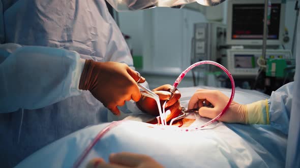 Surgical tools in doctor's hands alt