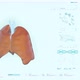 Modern x-ray monitoring technology has found covid-19 virus in patients lungs - VideoHive Item for Sale