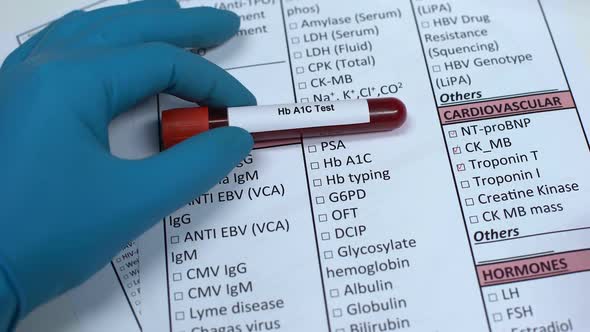Hb A1C Test, Doctor Checking Name in Lab Blank, Showing Blood Sample in Tube alt