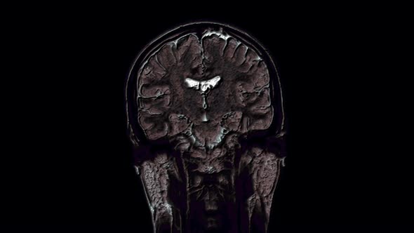 Voluminous Color MRI Scans of the Brain and Head To Detect Tumors. Diagnostic Medical Tool alt