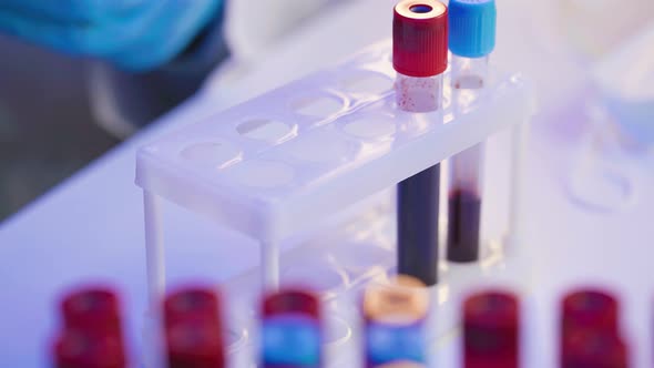 Lab Assistant in Gloves Putting Blood Test Tubes in Rack or Holder Close Up alt