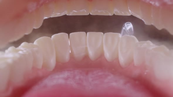 Water Flosser Cleaning Teeth on Black alt