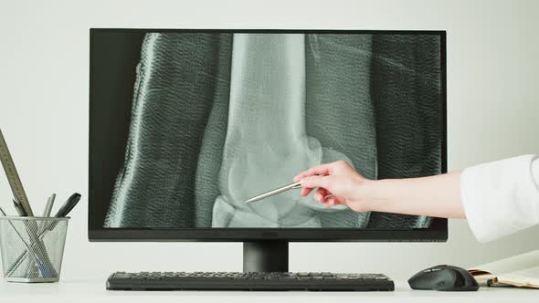 Doctor Veterinarian Examining Horse Leg Skeleton Roentgen on Computer Monitor alt