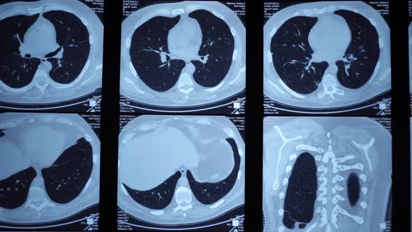 X-rays of light 10 alt