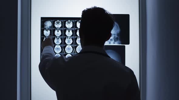 Doctor analysing the X-rays alt