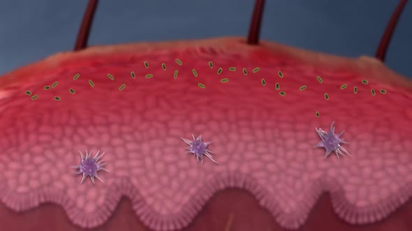 The attack of airborne bacteria on the skin wound and the activation of the immune system alt