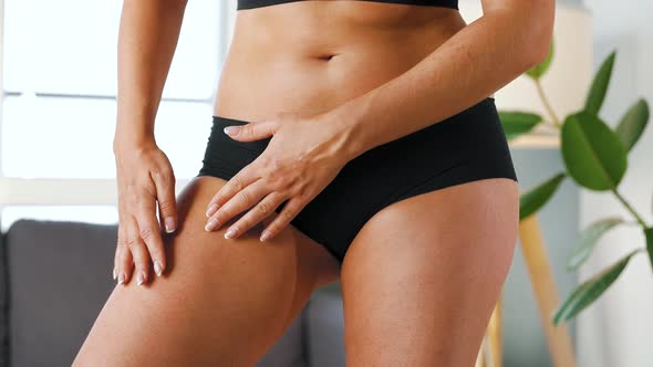 Woman Compressing the Skin on Her Legs Checking for Cellulite and Excess Subcutaneous Fat alt