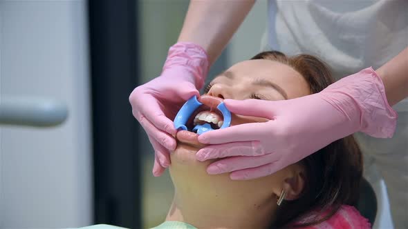 Doctor Removes Dental Retractor From Patient's Mouth alt