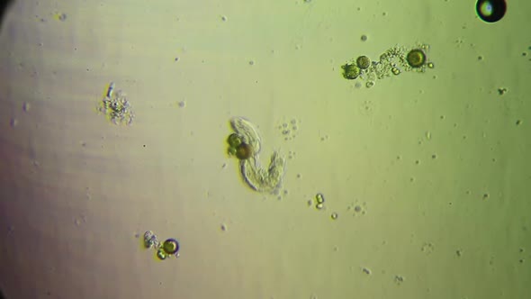 Microscopy: Chaetonotus