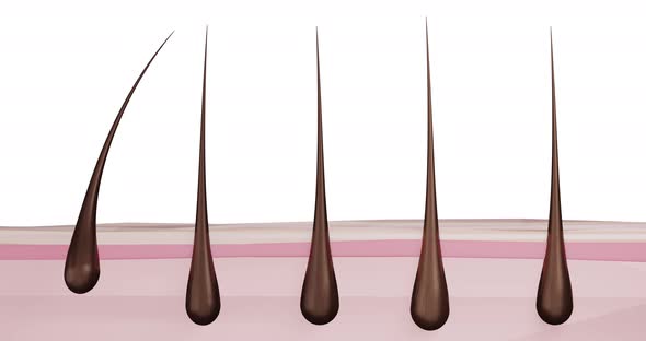 3d Render Animation Of Hair Removal From The Hair Follicle, Hair Removal, Hair Loss