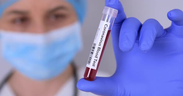 Nurse Holding Test Tube with Positive Coronavirus Test Blood 